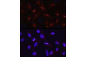 Immunofluorescence analysis of U2OS cells using SIRT7 Rabbit pAb (ABIN3021210, ABIN3021211, ABIN3021212 and ABIN6214068) at dilution of 1:50 (40x lens).