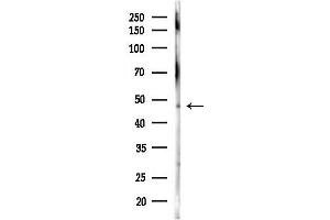 anti-Selenophosphate Synthetase 2 (SEPHS2) antibody