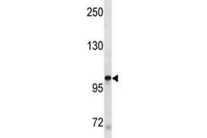 KIT antibody western blot analysis in A549 lysate
