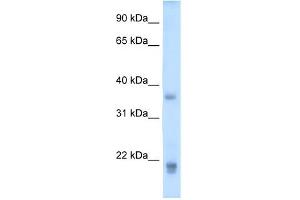 WB Suggested Anti-GH2 Antibody Titration:  5. (Growth Hormone 2 Antikörper  (Middle Region))