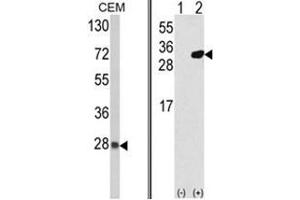 (LEFT) Western blot analysis of PRDX6 Antibody (C-term) in CEM cell line lysates (35ug/lane). (Peroxiredoxin 6 Antikörper  (C-Term))