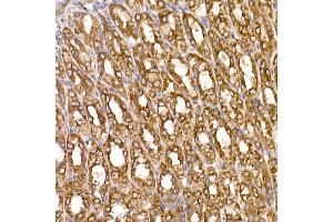 Immunohistochemistry (IHC) image for anti-Thioredoxin Domain Containing 12 (Endoplasmic Reticulum) (TXNDC12) antibody (ABIN7270799)
