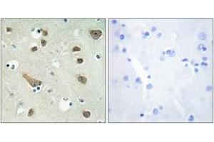 Immunohistochemistry analysis of paraffin-embedded human brain tissue, using 14-3-3 gamma Antibody. (14-3-3 gamma Antikörper  (AA 51-100))