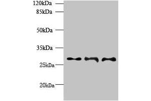Western blot All lanes: BARX1 antibody at 6 μg/mL Lane 1: Hela whole cell lysate Lane 2: Jurkat whole cell lysate Lane 3: CEM whole cell lysate Secondary Goat polyclonal to rabbit IgG at 1/10000 dilution Predicted band size: 28, 12 kDa Observed band size: 28 kDa (BARX1 Antikörper  (AA 1-100))