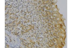 ABIN6277150 at 1/100 staining Human gastric tissue by IHC-P. (HLA-DQA1 Antikörper)