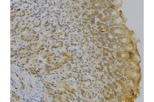 ABIN6277150 at 1/100 staining Human gastric tissue by IHC-P.
