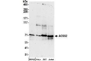 Western Blotting (WB) image for anti-Acyl-CoA Synthetase Short-Chain Family Member 2 (ACSS2) (AA 450-500) antibody (ABIN7453020)