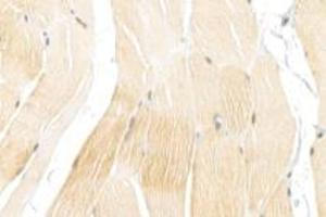 Immunohistochemistry analysis of paraffin-embedded rat skin using,alpha Actinin (ABIN7073023) at dilution of 1: 900