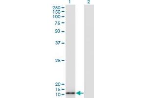 Western Blot analysis of S100A7 expression in transfected 293T cell line by S100A7 monoclonal antibody (M07A), clone 3E11. (S100A7 Antikörper  (AA 1-101))