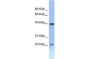 WB Suggested Anti-HOXA2 Antibody Titration: 1. (HOXA2 Antikörper  (C-Term))