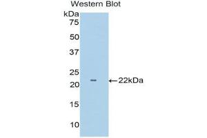 Western Blotting (WB) image for anti-Tumor Necrosis Factor Receptor Superfamily, Member 1B (TNFRSF1B) (AA 303-474) antibody (ABIN3206519) (TNFRSF1B Antikörper  (AA 303-474))