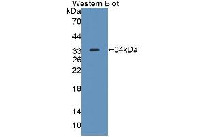 Detection of Recombinant ABCG8, Mouse using Polyclonal Antibody to ATP Binding Cassette Transporter G8 (ABCG8) (ABCG8 Antikörper  (AA 1-272))