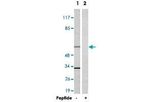 Western blot analysis of extracts from 293 cells, using TRAF3IP3 polyclonal antibody . (TRAF3IP3 Antikörper)