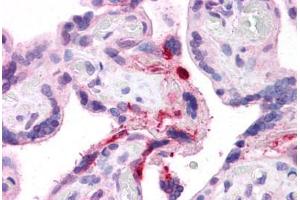 Immunohistochemistry (Formalin-fixed Paraffin-embedded Sections) (IHC (fp)) image for anti-Leucine Rich Repeat Containing 8 Family, Member B (LRRC8B) (AA 542-591) antibody (ABIN6745738)