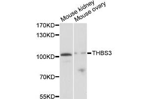 Western blot analysis of extracts of various cell lines, using THBS3 antibody (ABIN1875090) at 1:1000 dilution. (THBS3 Antikörper)