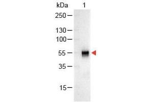 Lane 1: Rabbit IgG. (Ziege anti-Kaninchen IgG (Heavy & Light Chain) Antikörper (Alkaline Phosphatase (AP)))