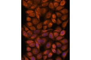 Immunofluorescence (IF) image for anti-Sorting Nexin 15 (SNX15) (AA 1-342) antibody (ABIN6148238)