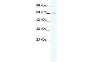 WB Suggested Anti-ZNF79 Antibody   Titration: 0. (ZNF79 Antikörper  (N-Term))