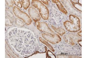Immunoperoxidase of purified MaxPab antibody to CDH16 on formalin-fixed paraffin-embedded human kidney. (Cadherin-16 Antikörper  (AA 1-829))