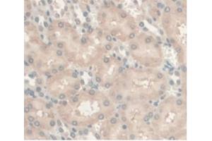 Detection of AR in Rat Kidney Tissue using Monoclonal Antibody to Androgen Receptor (AR) (Androgen Receptor Antikörper  (AA 491-679))