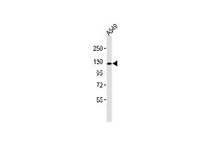 Anti-CD49e LC Antibody at 1:1000 dilution + A549 whole cell lysates Lysates/proteins at 20 μg per lane. (CD49e LC Antikörper)