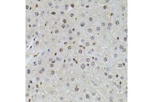 Immunohistochemistry of paraffin-embedded mouse liver using PLK4 antibody (ABIN6003595) at dilution of 1/100 (40x lens). (PLK4 Antikörper)