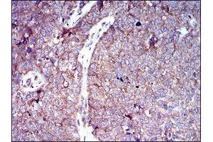 Immunohistochemistry (IHC) image for anti-Solute Carrier Family 2 (Facilitated Glucose Transporter), Member 4 (SLC2A4) (AA 224-353) antibody (ABIN1846354)