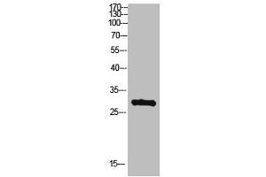 Western Blot analysis of hepg2 cells using Antibody diluted at 500. (MYOZ2 Antikörper  (AA 21-70))