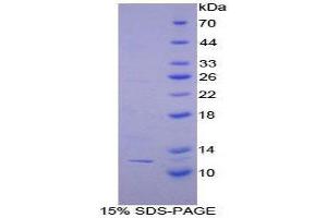 SDS-PAGE (SDS) image for Peptide YY (PYY) (AA 30-98) protein (His tag) (ABIN1879947)