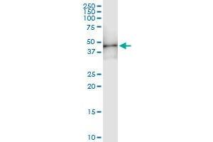 Immunoprecipitation of HOXD1 transfected lysate using anti-HOXD1 MaxPab rabbit polyclonal antibody and Protein A Magnetic Bead , and immunoblotted with HOXD1 MaxPab mouse polyclonal antibody (B01) . (HOXD1 Antikörper  (AA 1-328))