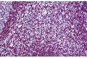 Human Tonsil: Formalin-Fixed, Paraffin-Embedded (FFPE) (MECP2 Antikörper  (AA 81-170))