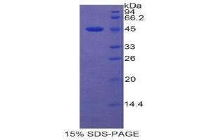 SDS-PAGE (SDS) image for Lipocalin 5 (LCN5) (AA 22-177) protein (His tag,GST tag) (ABIN1877715) (LCN5 Protein (AA 22-177) (His tag,GST tag))
