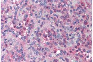 Human Spleen (formalin-fixed, paraffin-embedded) stained with XAF1 antibody ABIN214019 at 10 ug/ml followed by biotinylated goat anti-rabbit IgG secondary antibody ABIN481713, alkaline phosphatase-streptavidin and chromogen. (XAF1 Antikörper)