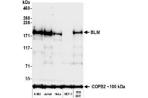 Western Blotting (WB) image for anti-Bloom Syndrome RecQ Like Helicase (BLM) (C-Term) antibody (ABIN7795725) (Rekombinanter BLM Antikörper  (C-Term))