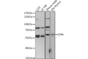 Western blot analysis of extracts of various cell lines, using CERK antibody (ABIN7266282) at 1:1000 dilution. (CERK Antikörper  (C-Term))