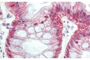 Detection of MTF1 in Human Colon Tissue using Polyclonal Antibody to Metal Regulatory Transcription Factor 1 (MTF1) (MTF1 Antikörper  (AA 2-139))