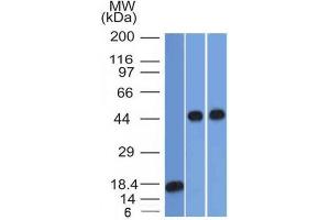 Western Blot Analysis of 1) recombinant Alpha-1-Antitrypsin 2) Jurkat & 3) A549 cell lysate using Alpha-1-Antitrypsin Mouse Monoclonal Antibody (AAT/1378). (SERPINA1 Antikörper)