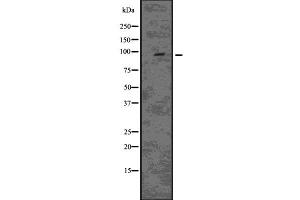 anti-Epidermal Growth Factor Receptor Pathway Substrate 15-Like 1 (EPS15L1) (C-Term) antibody