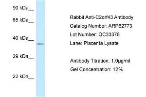 Western Blotting (WB) image for anti-Lipid Droplet-Associated Hydrolase (LDAH) (C-Term) antibody (ABIN2789241) (LDAH/C2orf43 Antikörper  (C-Term))