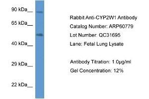 Western Blotting (WB) image for anti-Cytochrome P450, Family 2, Subfamily W, Polypeptide 1 (CYP2W1) (C-Term) antibody (ABIN786271) (CYP2W1 Antikörper  (C-Term))