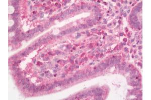 Human Small Intestine: Formalin-Fixed, Paraffin-Embedded (FFPE)