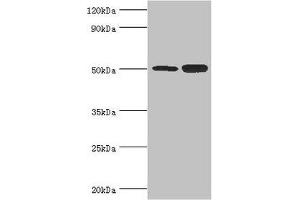 Western blot All lanes: Polycomb protein EED antibody at 4 μg/mL Lane 1: Hela whole cell lysate Lane 2: K562 whole cell lysate Secondary Goat polyclonal to rabbit IgG at 1/10000 dilution Predicted band size: 51, 54, 46 kDa Observed band size: 51 kDa (EED Antikörper  (AA 1-300))