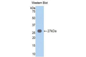 Western Blotting (WB) image for anti-Vav 3 Oncogene (VAV3) (AA 183-380) antibody (ABIN3203801) (VAV3 Antikörper  (AA 183-380))
