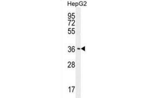Western Blotting (WB) image for anti-CCR4-NOT Transcription Complex, Subunit 8 (CNOT8) antibody (ABIN2996023) (CNOT8 Antikörper)