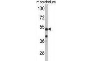 Western Blotting (WB) image for anti-Cyclin-Dependent Kinase 14 (CDK14) antibody (ABIN3002794) (CDK14 Antikörper)