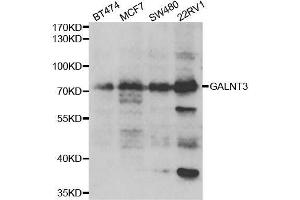 Western blot analysis of extracts of various cell lines, using GALNT3 antibody. (GALNT3 Antikörper  (AA 1-140))