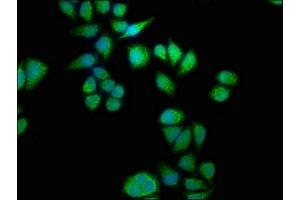 Immunofluorescence staining of Hela cells with ABIN7168857 at 1:133, counter-stained with DAPI. (Septin 11 Antikörper  (AA 237-429))
