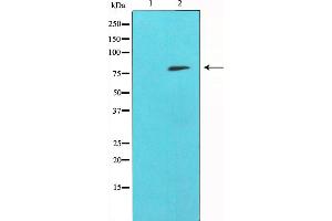 Western blot analysis of SYK expression in whole cell lysates,The lane on the left is treated with the antigen-specific peptide. (SYK Antikörper)