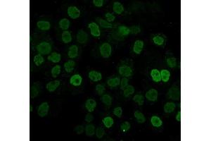 IF analysis of hnRNP D/AUF1/HNRNPD using anti-hnRNP D/AUF1/HNRNPD antibody (ABIN7602592). (HNRNPD/AUF1 Antikörper  (AA 88-246))