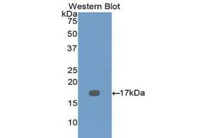Western Blotting (WB) image for anti-Dymeclin (DYM) (AA 546-669) antibody (ABIN1111113) (Dymeclin Antikörper  (AA 546-669))